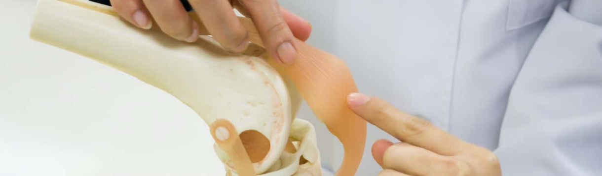 banner ortopediaCentro de Ortopedia y Traumatología Especialista armando una prótesis